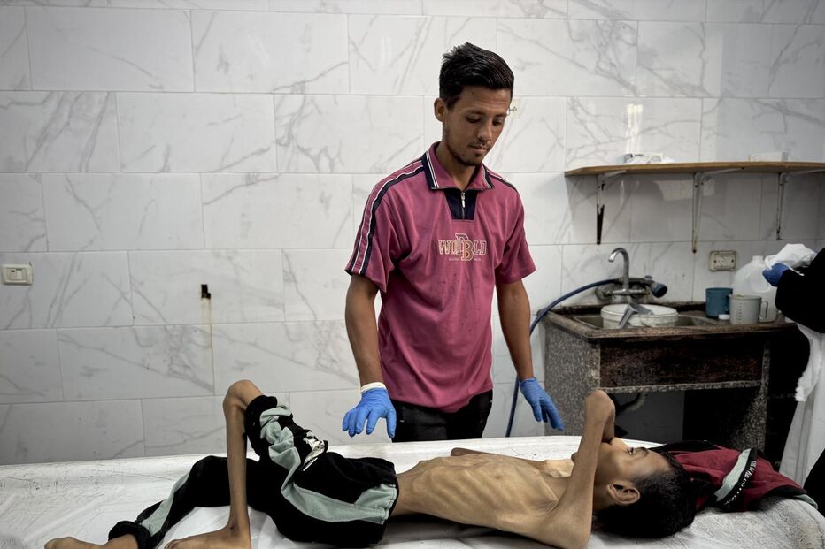 Há crianças a morrer à fome todos os dias em Gaza 