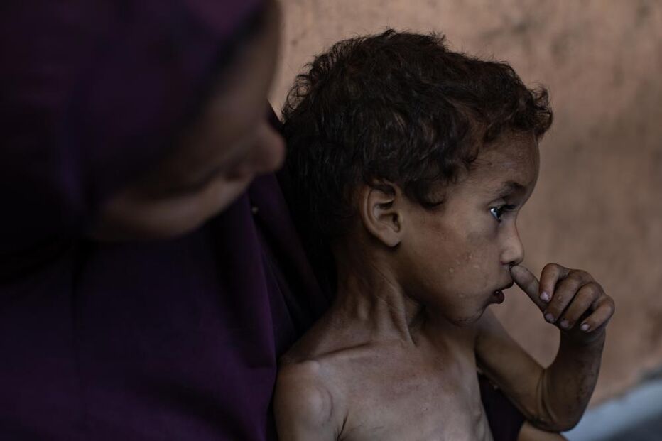 Há crianças a morrer à fome todos os dias em Gaza 