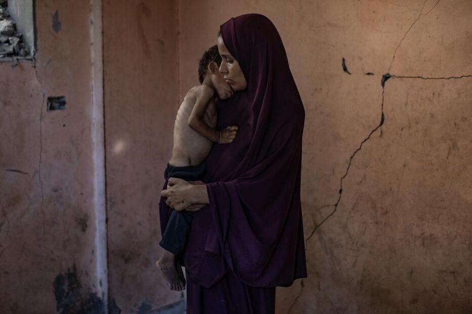 Há crianças a morrer à fome todos os dias em Gaza 
