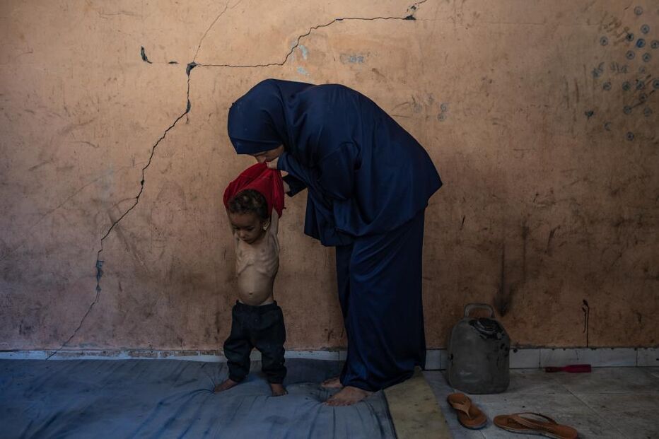 Há crianças a morrer à fome todos os dias em Gaza 