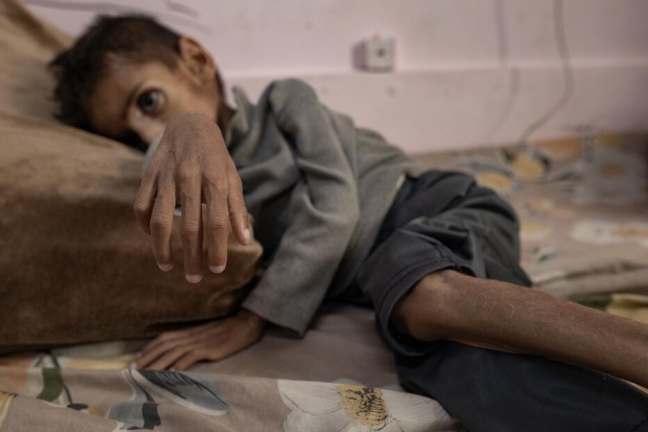 Há crianças a morrer à fome todos os dias em Gaza 