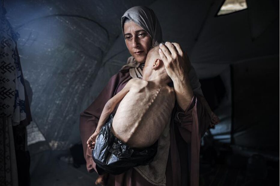 Há crianças a morrer à fome todos os dias em Gaza 