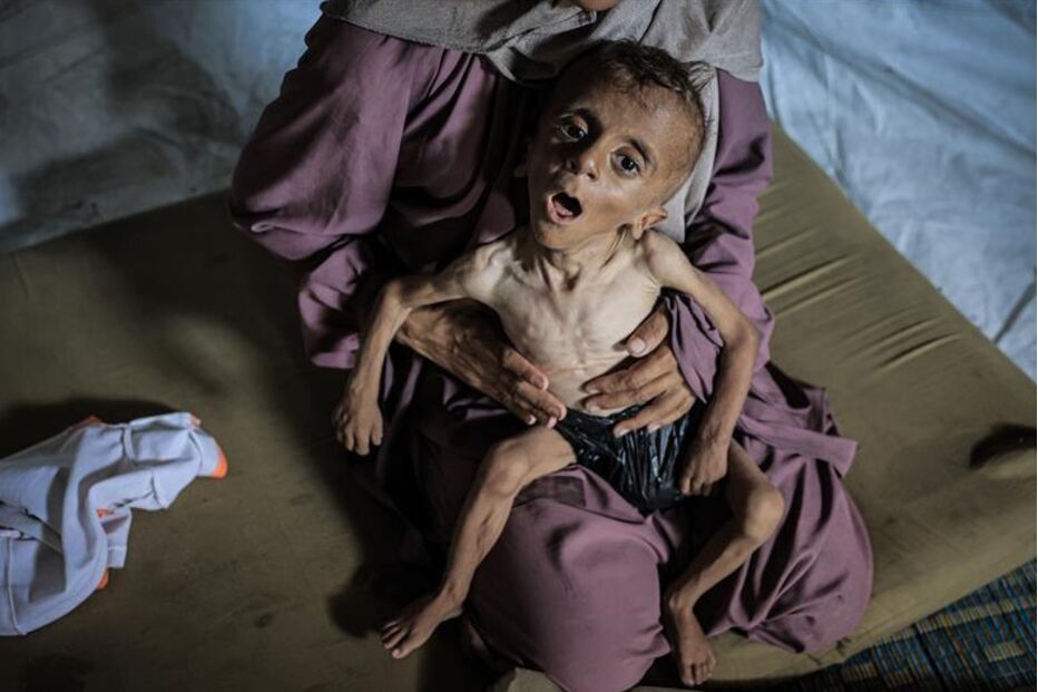 Há crianças a morrer à fome todos os dias em Gaza 