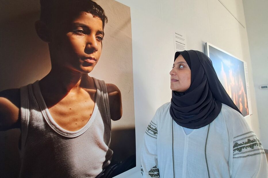 Mahmoud ficou sem os dois braços em bombardeamento