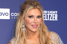 Brandi Glanville sofre queimaduras no rosto após usar creme depilatório para eliminar parasita