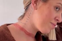 Influenciadora Eli Moulton alerta para perigo de lenços após acidente quase fatal