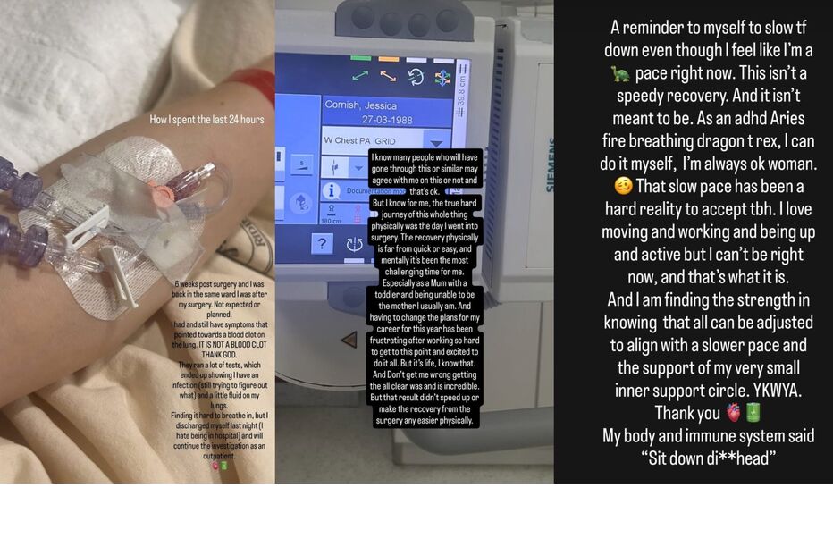 Jessie J internada após suspeita de coágulo no pulmão e infeção