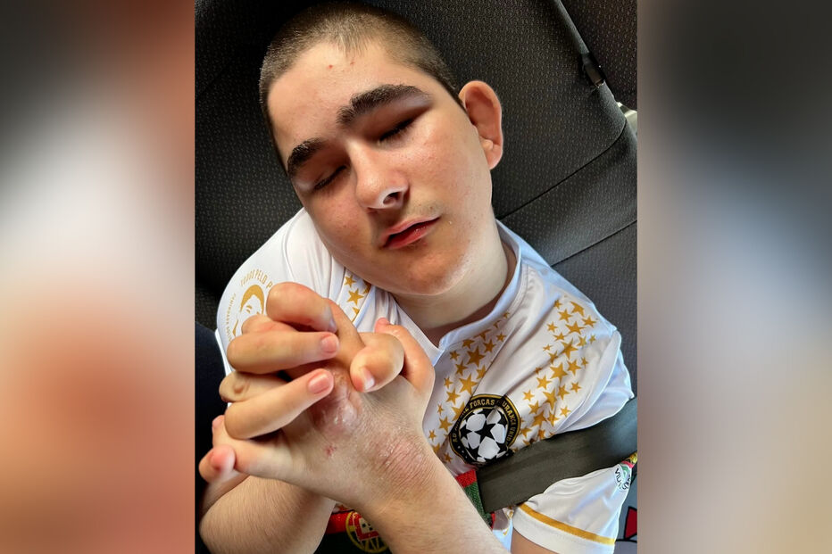 Pipinho não anda, não fala e não vê