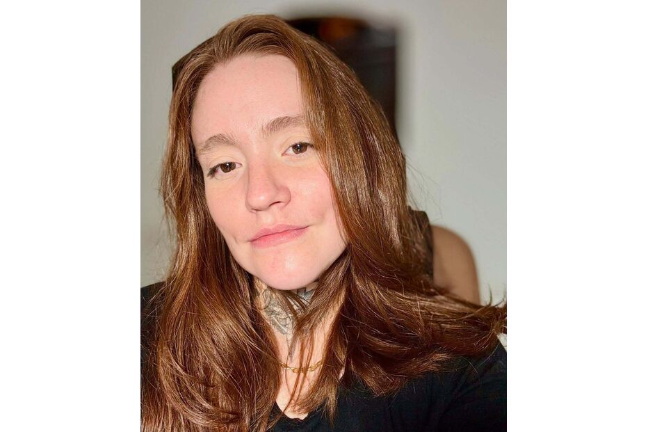 Carolina Arruda pondera eutanásia devido a neuralgia do trigémeo