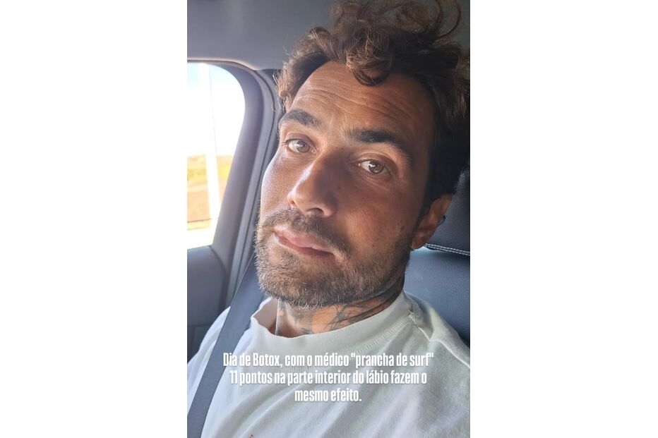 Miguel Mouzinho depois de ir ao hospital.jpeg