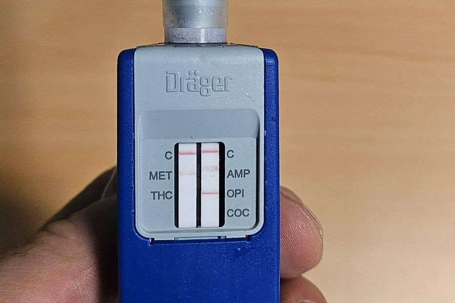 Condutor acusa excesso de álcool e consumo de drogas; trotinete foi apreendida!