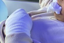 Agrupamento de Escolas de Souselo em Cinfães investiga amputação de dedos de aluno