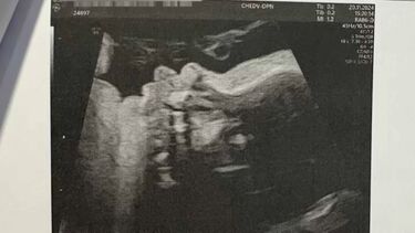 Relatório da autópsia feita ao bebé refere problemas cardíacos que nunca foram reportados à mãe