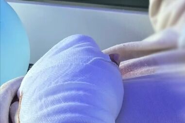 Agrupamento de Escolas de Souselo em Cinfães investiga amputação de dedos de aluno