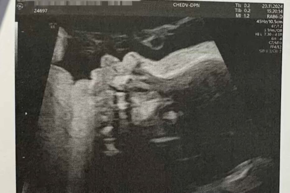 Relatório da autópsia feita ao bebé refere problemas cardíacos que nunca foram reportados à mãe