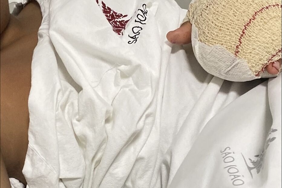 Agrupamento de Escolas de Souselo em Cinfães investiga amputação de dedos de aluno