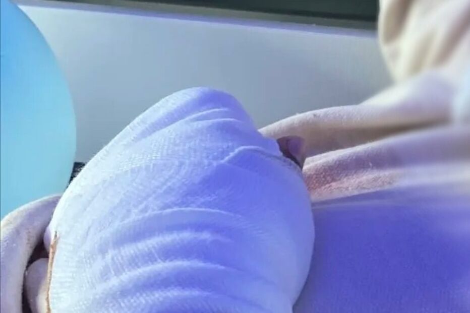 Agrupamento de Escolas de Souselo em Cinfães investiga amputação de dedos de aluno