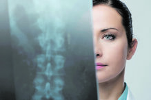 Descoberto tratamento para lesão na medula