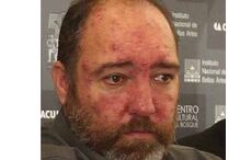 Espanhol foragido à justiça detido em Évora