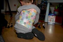 Lourenço, o menino de 4 anos que nasceu com o coração do lado errado sem que os médicos detetassem. Veja agora na CMTV