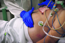 Excesso de mortalidade identificado em semana de epidemia de gripe. Há mais 121 mortes face ao habitual