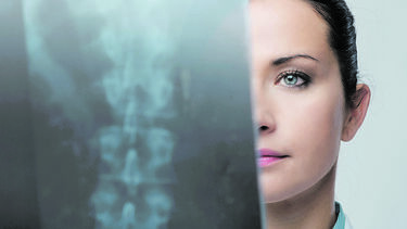 Descoberto tratamento para lesão na medula