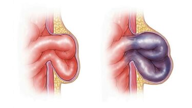 Médico explica o que aconteceu com Marcelo Rebelo de Sousa