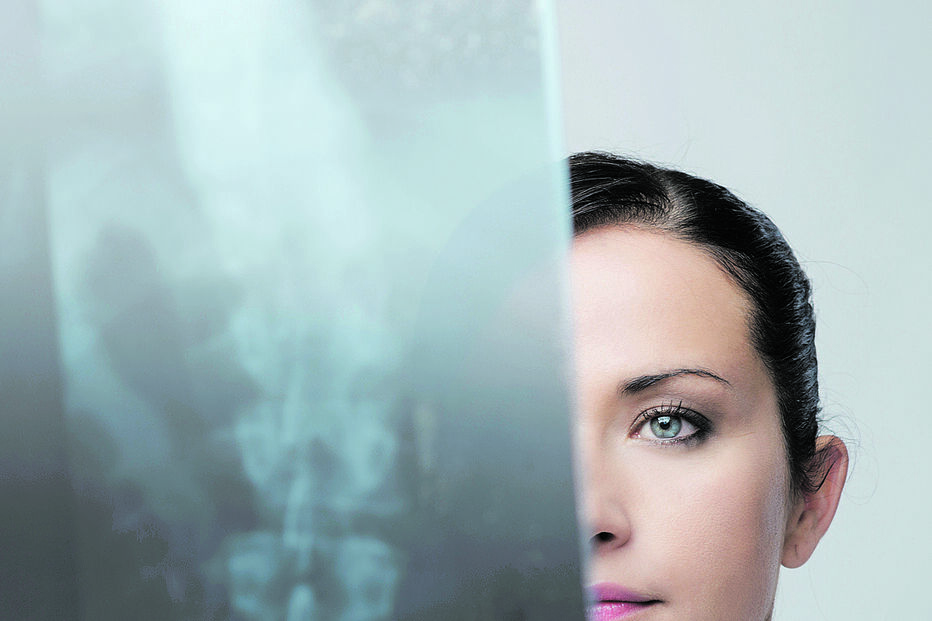 Injeção de polilaminina permite recuperar lesões na medula