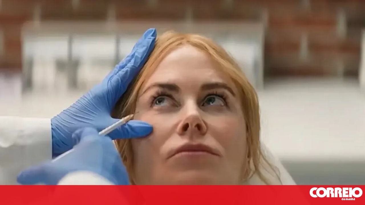 I had Botox at 50. Too late or at the right time?