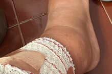 Ex-concorrente do 'Love On Top' expõe complicação após tatuagem 