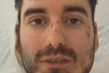 'Por sorte estou vivo': o testemunho do português vítima do desastre ferroviário em Espanha