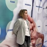  Carme, recebeu transplante de cara