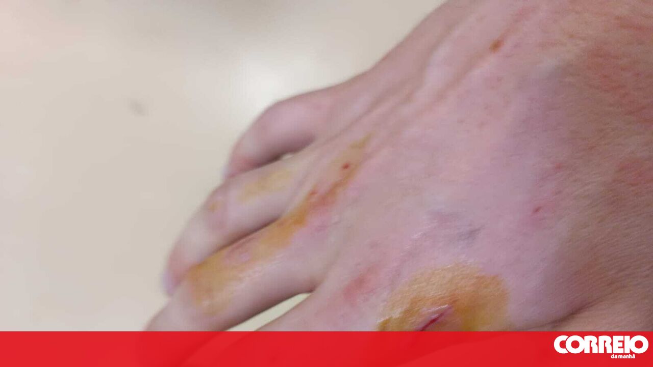 Man faces prison for stoning and biting two municipal police officers in Matosinhos