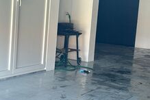 Pai e filho queimam-se em fogareiro e ficam em estado grave em Borba