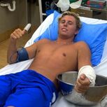 Surfista recupera após ataque de medusa em Fiji