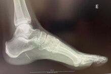 Pureza Mello Breyner