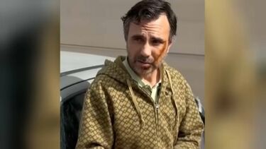 Português fica desfigurado depois de ser esfaqueado em Málaga