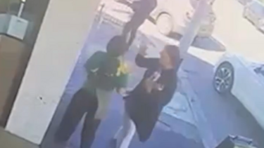 Empregada de café fica com dente partido após agressão inesperada de cliente na Austrália 