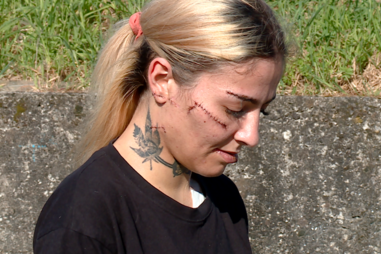 Marcas do esfaqueamento são ainda visíveis.