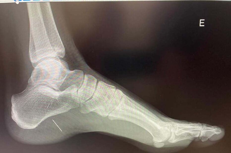 Pureza Mello Breyner