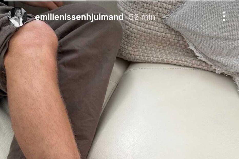 Hjulmand sofreu uma lesão grave no pé, exibida pela sua companheira