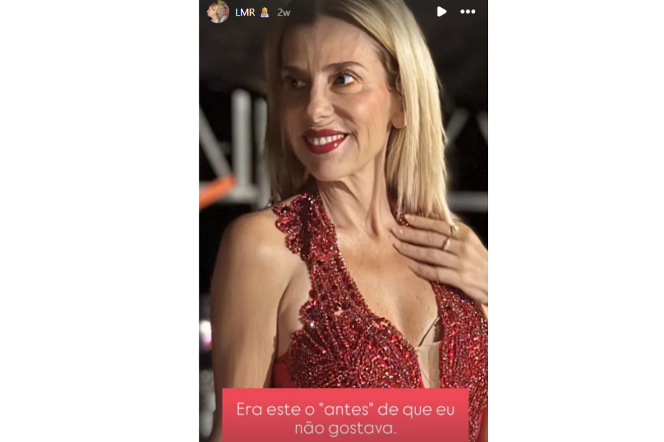 Mónica Sintra revela cirurgia estética 