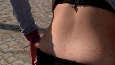 Praga de pulgas persiste na Maia sem solução à vista