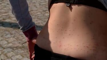 "Encontramos em todo o lado, na roupa, no calçado. Não aguentamos mais": Moradores desesperam com praga de pulgas na Maia