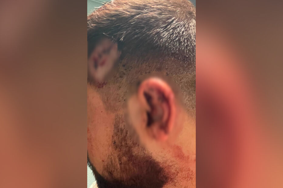 Militar da GNR fora de serviço agredido enquanto prestava auxílio a dona de quiosque em Évora
