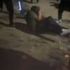 <![CDATA[ Jovem hospitalizado após agressão por grupo no Sabugal ]]>