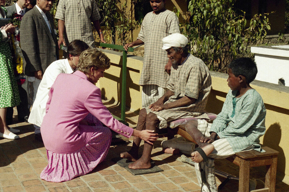 A princesa Diana, do Reino Unido, toca na perna de um doente de lepra no Hospital de Lepra de Anandaban, a sul de Katmandu, a 4 de março de 1993, no terceiro dia da visita de cinco dias da princesa ao Nepal