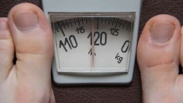 Comparticipação na obesidade restringe acesso e exlcui cuidados primários
